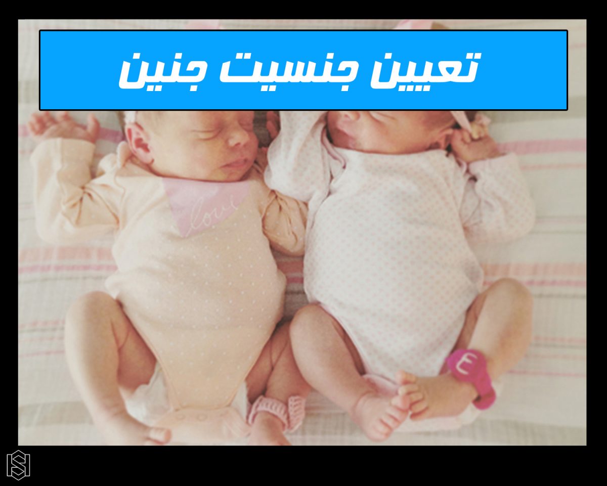 تشخیص جنسیت جنین