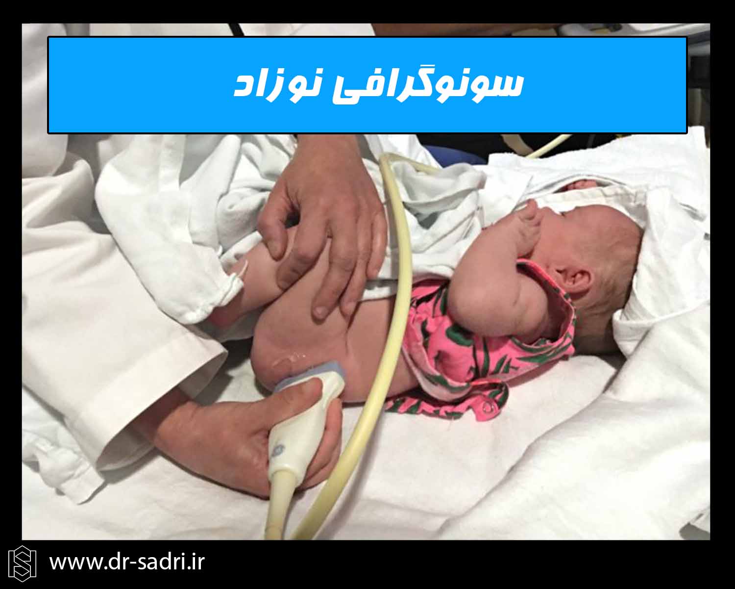 سونوگرافی نوزاد