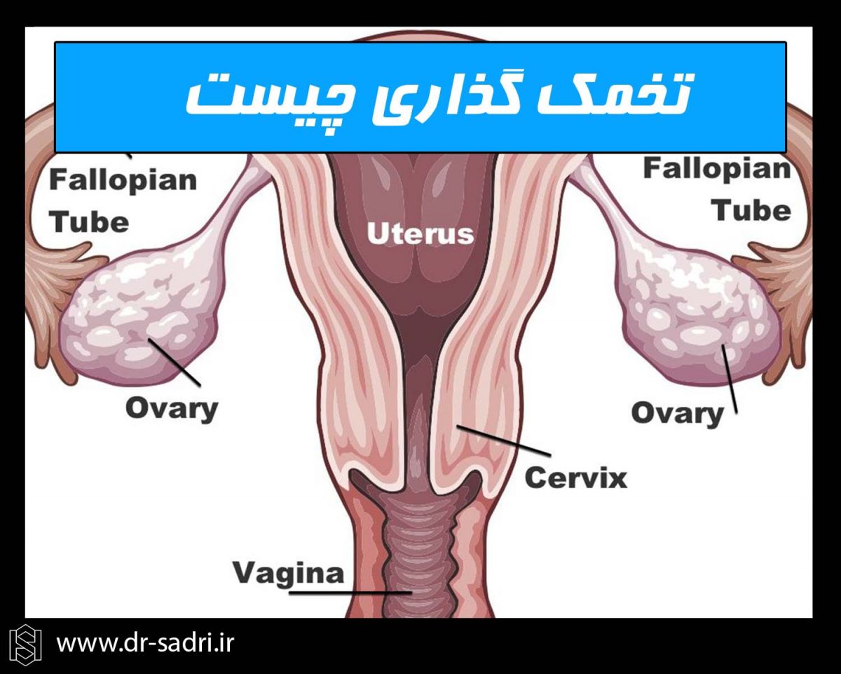 تعیین روز تخمک گذاری