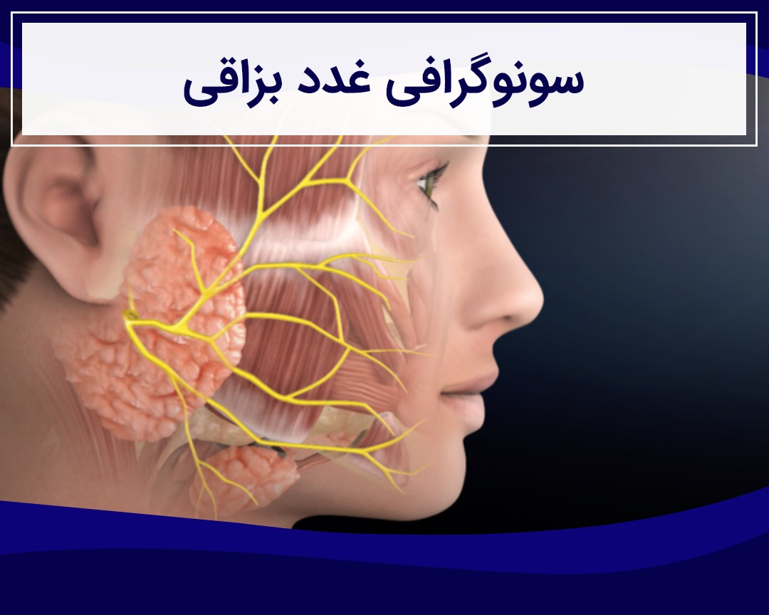 سونوگرافی غدد بزاقی